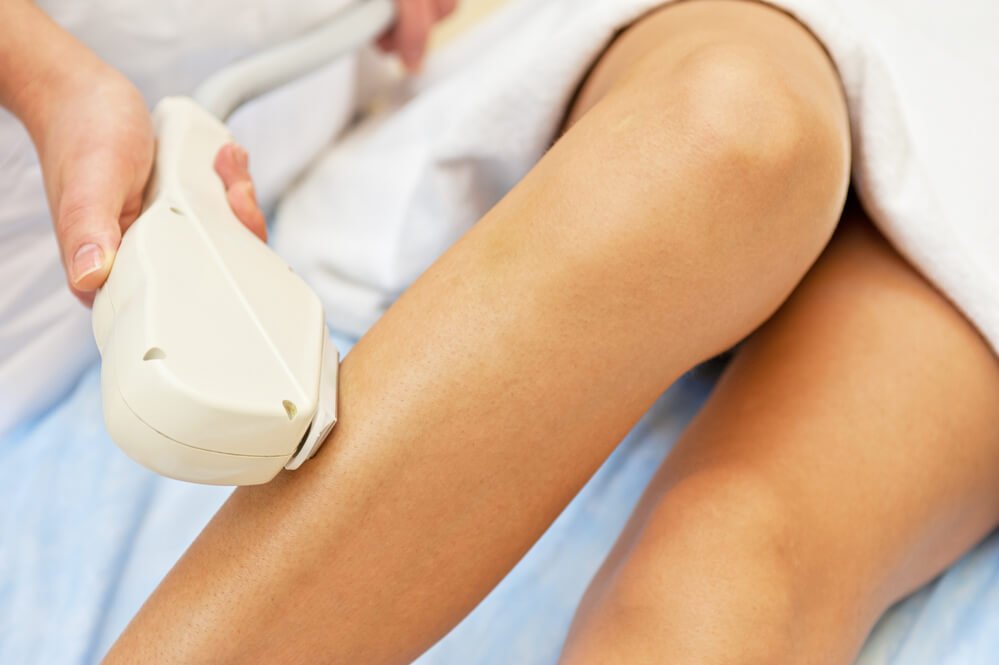 Why Laser Hair Removal is Most Recommended for Women