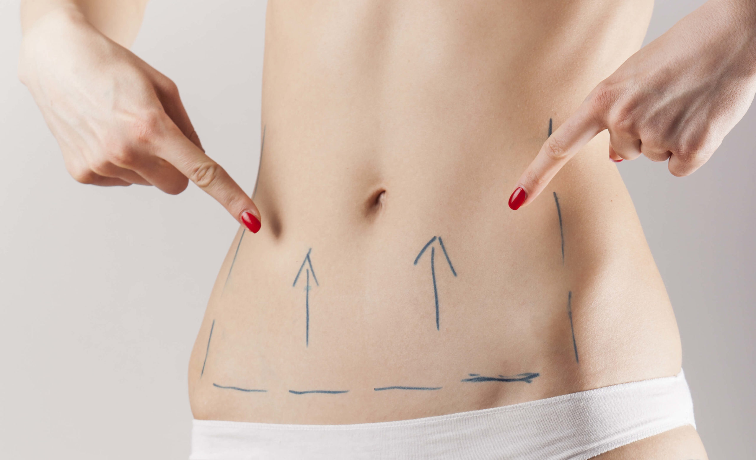 Tips to Consider Before you Get an Abdominoplasty