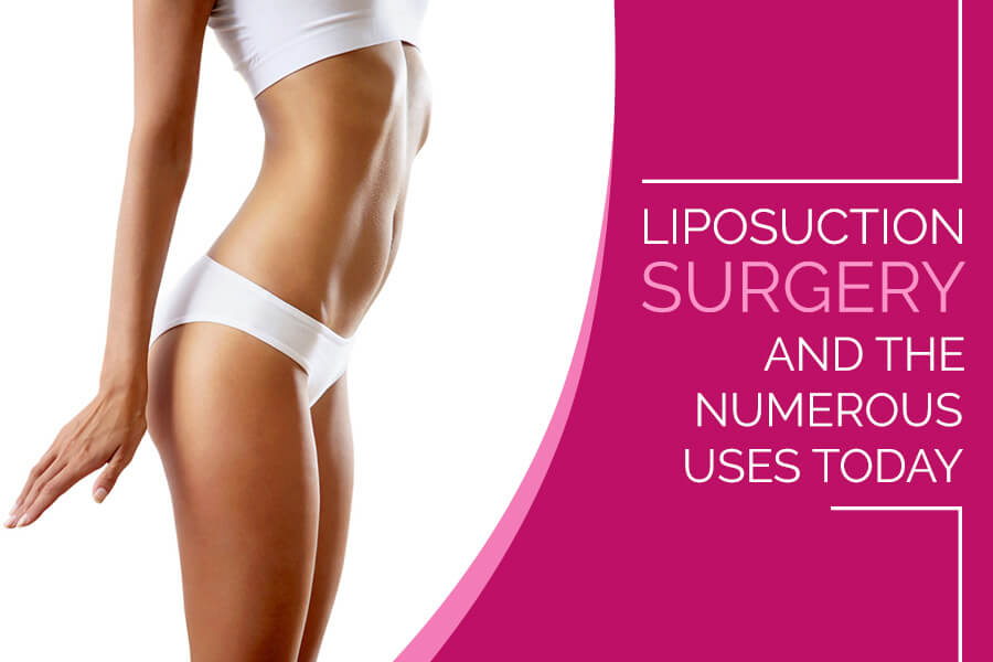 Liposuction Surgery and the Numerous Uses Today