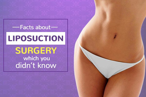 Facts about Liposuction Surgery which you didn’t Know