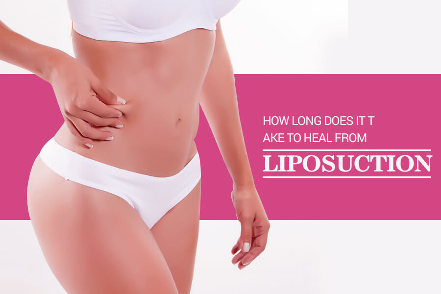 How Long Does It Take to Heal from Liposuction?