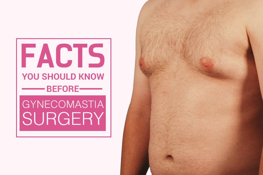 Facts you Should Know Before Gynecomastia Surgery