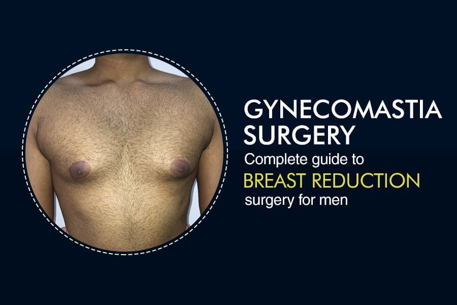 Gynecomastia Surgery – A Guide to Breast Reduction Surgery for Men
