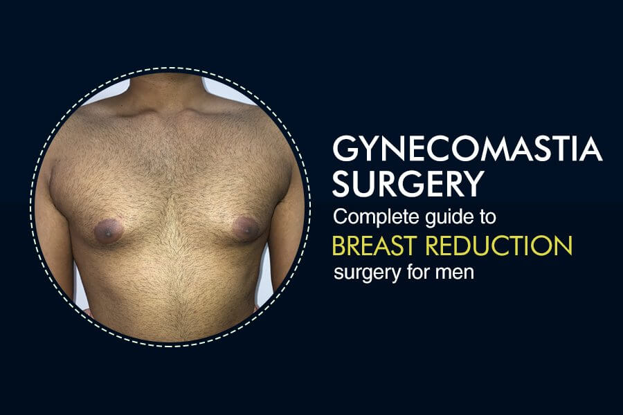 Breast Reduction Surgery for Men