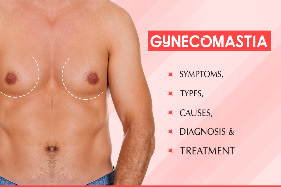 Gynecomastia Symptoms