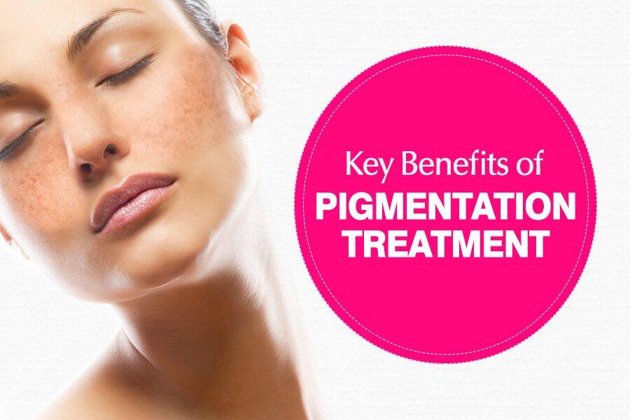 Key Benefits of Pigmentation Treatment