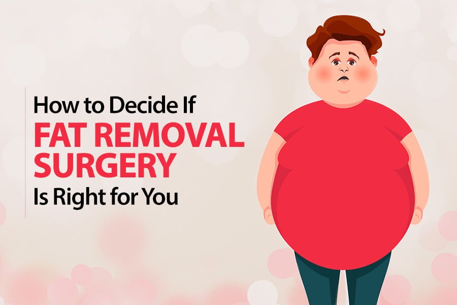 How to Decide If Fat Removal Surgery Is Right for You