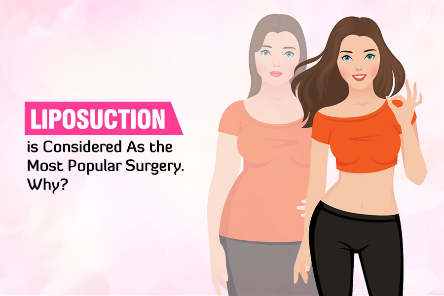 Liposuction is Considered As the Most Popular Surgery. Why