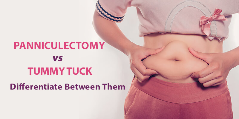 Panniculectomy vs. Tummy Tuck. Differentiate Between Them