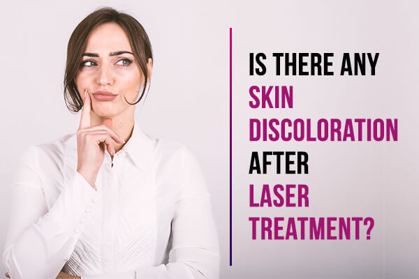 Skin Discoloration after Laser Treatment