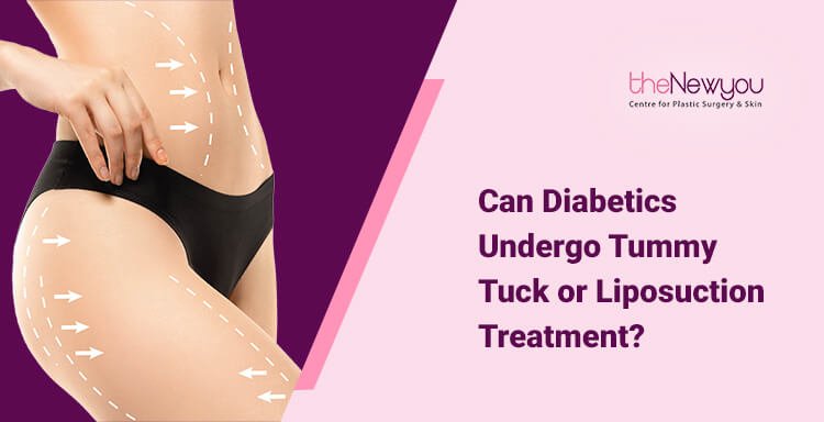  Can Diabetics Undergo Tummy Tuck or Liposuction Treatment?