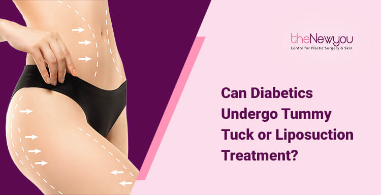 Can Diabetics Undergo Tummy Tuck or Liposuction Treatment?