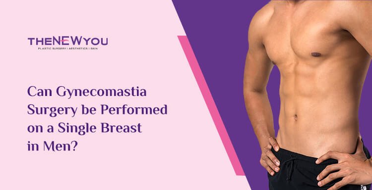 Can Gynecomastia Surgery be Performed on a Single Breast in Men?