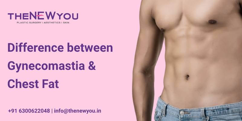 What is the Difference between Gynecomastia and Chest Fat?