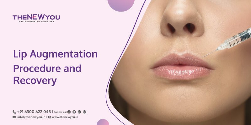 Procedure and Recovery of Lip Augmentation Surgery