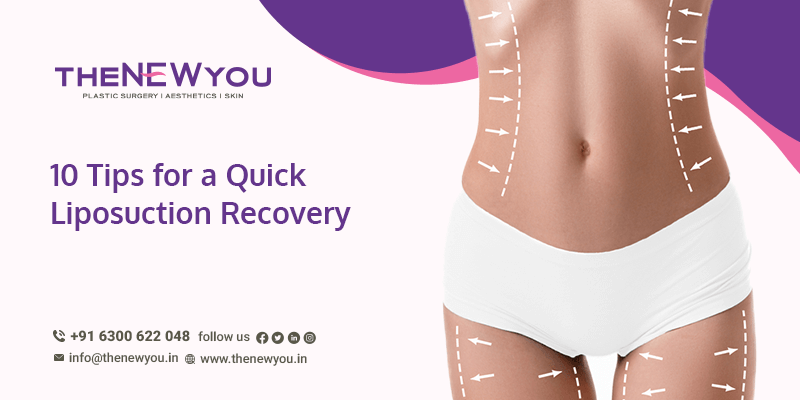 Liposuction Recovery: Everything you need to know about