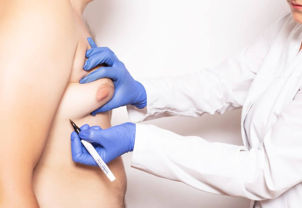 Gynecomastia Doctor Should Be Board-Certified