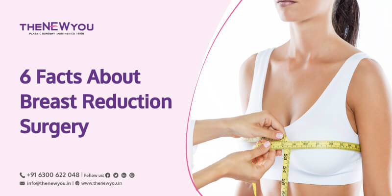 What Are Some Facts About Breast Reduction Surgery