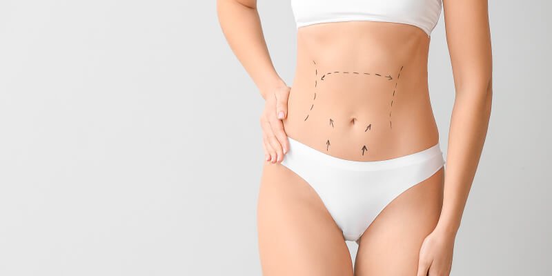 Recovery of Body Contouring