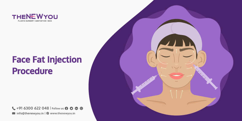 fat injection treatment in hyderabad, treatment for face fat