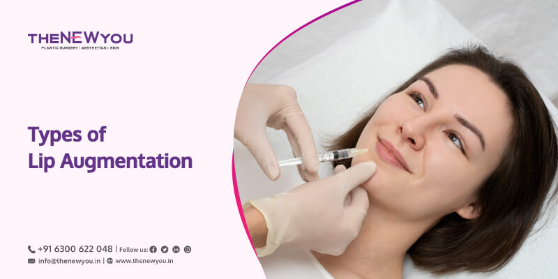 Types of Lip Augmentation, lip augmentation surgery