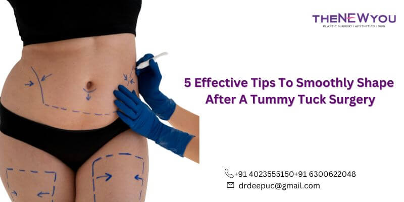 Shape After Tummy Tuck Surgery