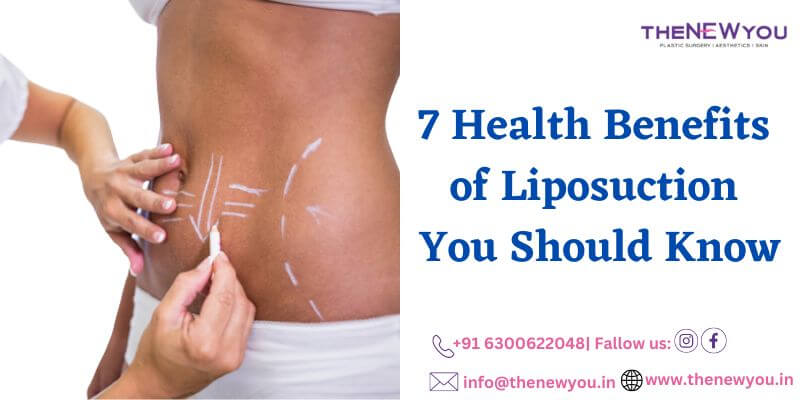 7 Important Benefits of Liposuction Surgery