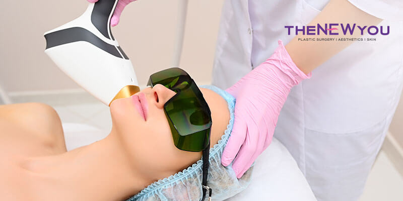 Fractional-Laser-Treatment