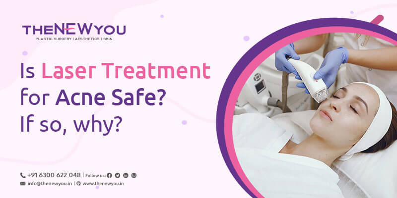 Is Laser Treatment for Acne Safe? If so, why?