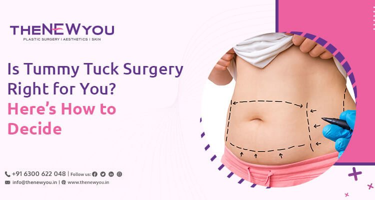 Tummy-tuck-surgery