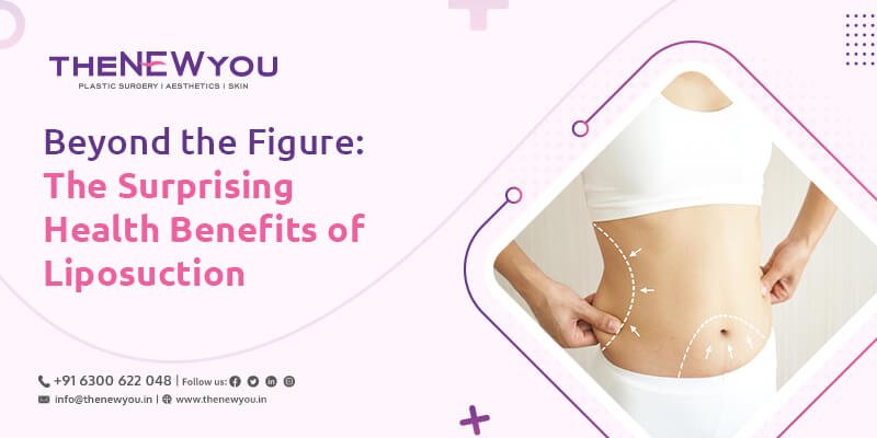  Beyond the Figure: The Surprising Health Benefits of Liposuction