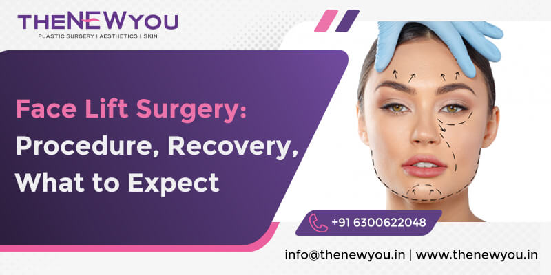 Face-Lift-Surgery