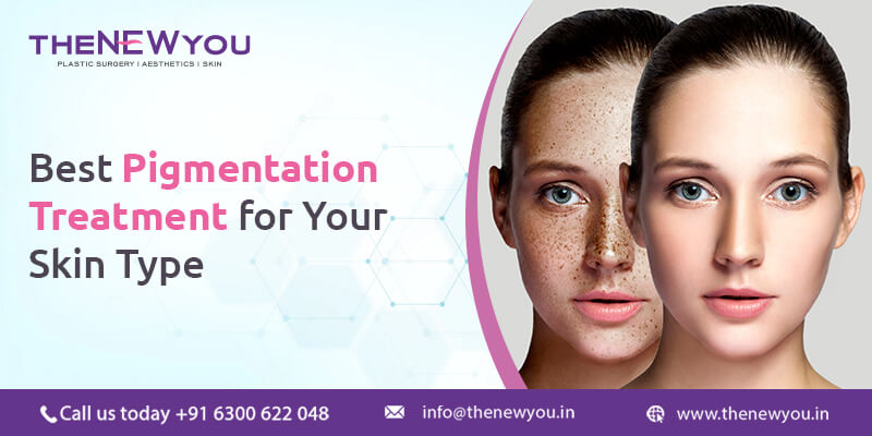 Best Pigmentation Treatment for Your Skin Type