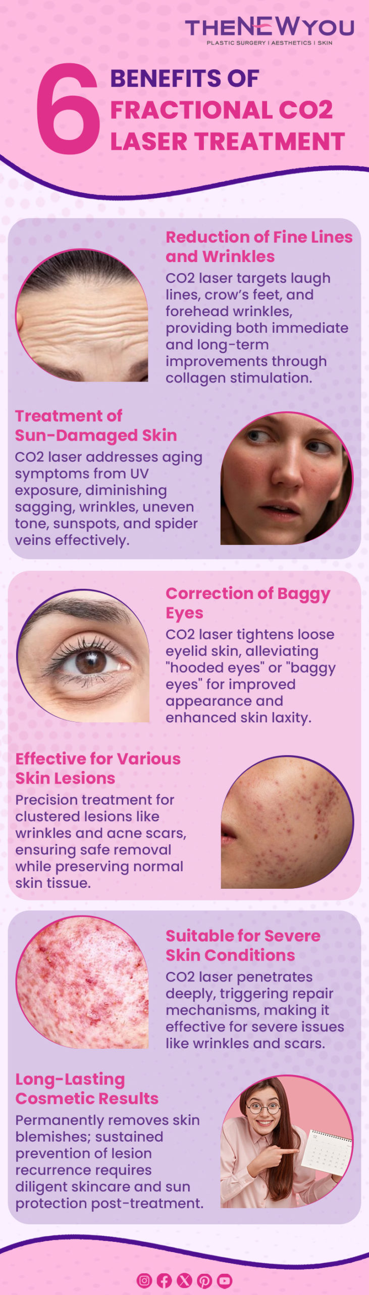 Infographic Benefits of Fractional CO2 Laser Treatment