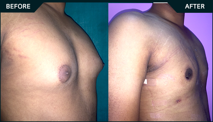 Patient-7-Before-after-side