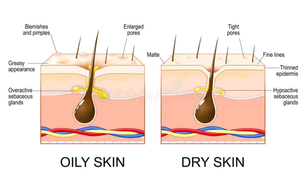 Skin Type