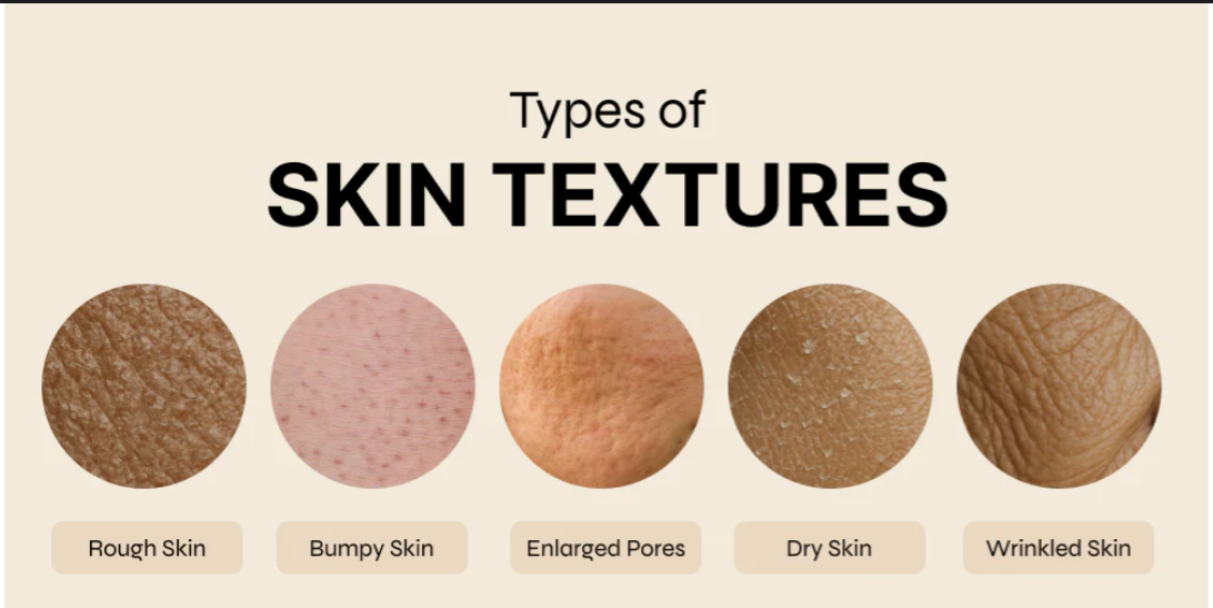 Open Pores & Breast Reduction