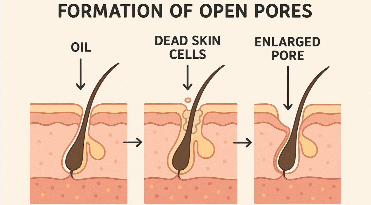 Open Pores
