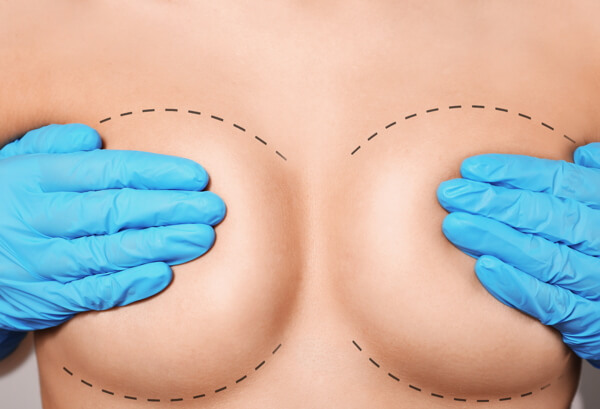 Breast Augmentation Surgery