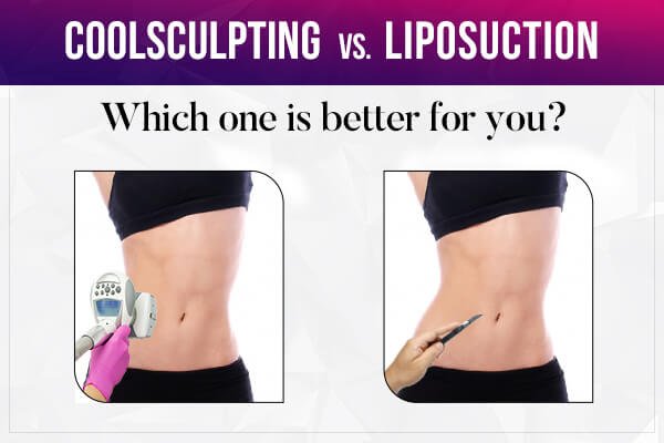 coolsculpting vs. liposuction