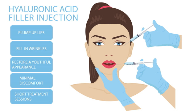 Hyaluronic Acid