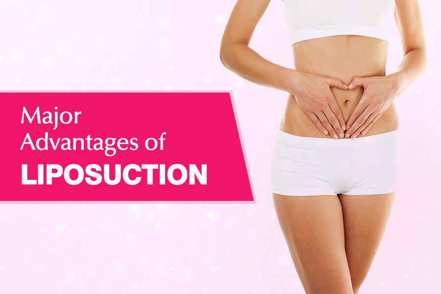 Major Advantages of Liposuction