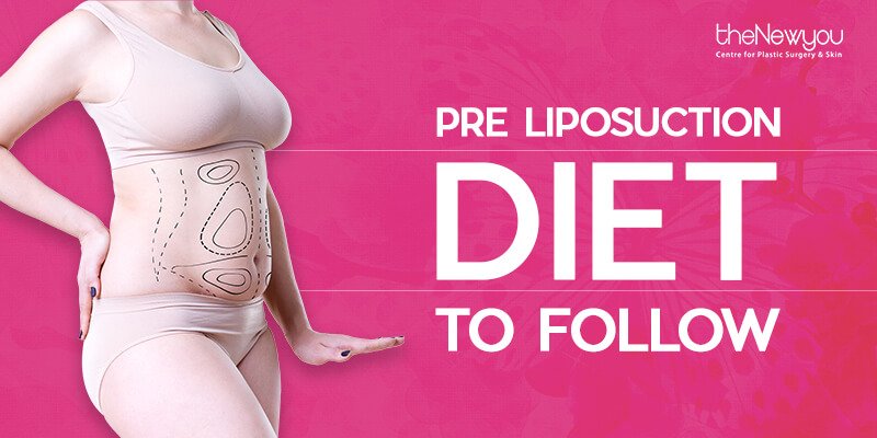 Pre-Liposuction Diet to Follow